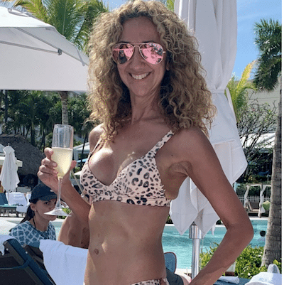 Breast Augmentation and Implants in Westport, CT