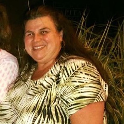 Breast Reduction Surgery in Westport, CT